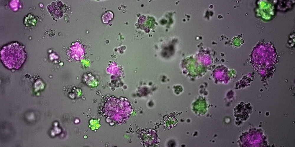 Basler Forscher mit Zufallsfund: Hustensaft kann gegen Brustkrebs helfen