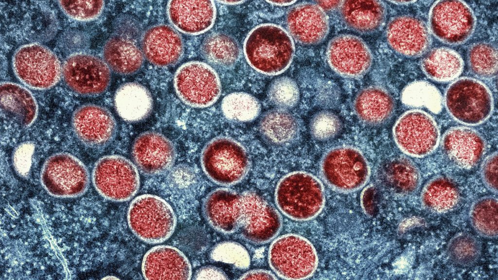 Schweiz sieht geringes Ausbreitungsrisiko der neuen Mpox-Variante
