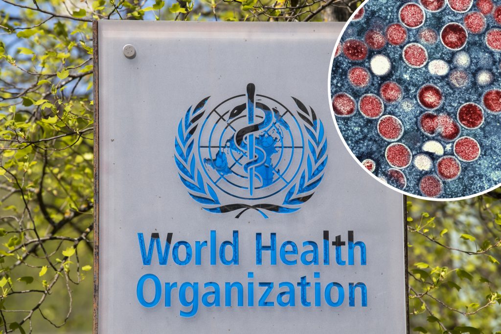 WHO ruft wegen Mpox weltweite Notlage aus