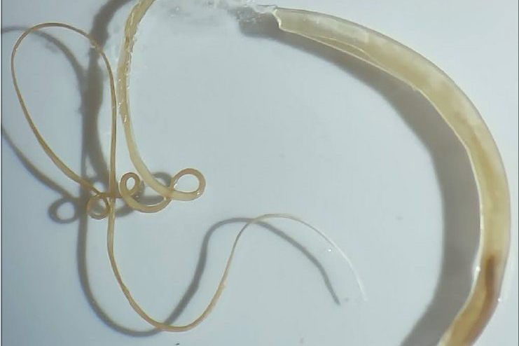 Forschungsteam des Tropeninstituts entdeckt neue parasitäre Wurmart