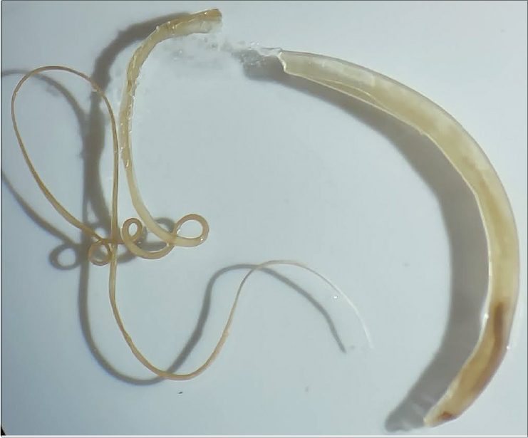 Forschungsteam des Tropeninstituts entdeckt neue parasitäre Wurmart