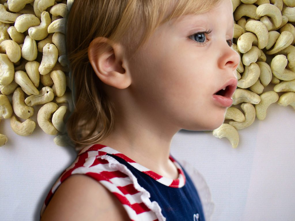 Immer mehr Kinder reagieren auf Cashewnüsse allergisch
