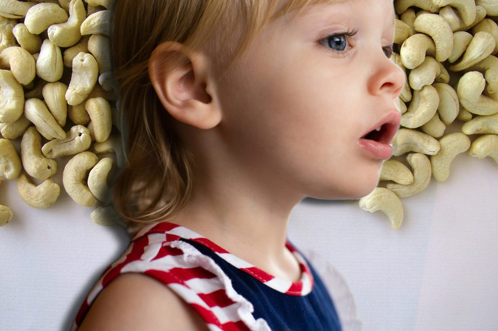 Immer mehr Kinder reagieren auf Cashewnüsse allergisch